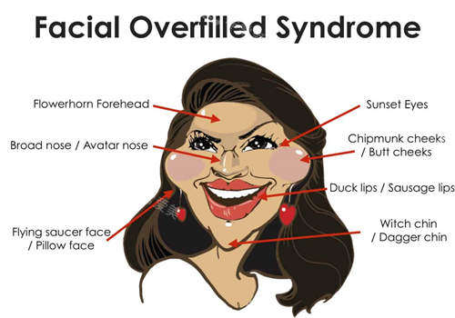 面部填充过度图