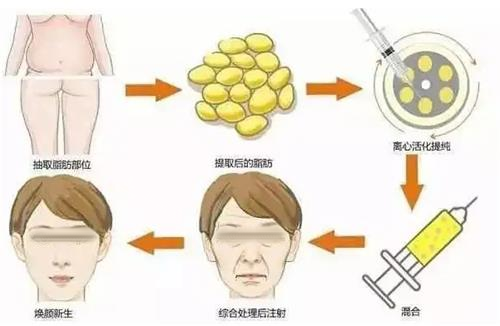 面部填充步骤图