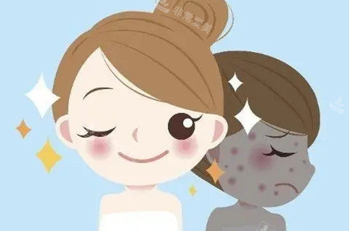 光子嫩肤前后对比卡通示意图 光子嫩肤前后对比卡通示意图