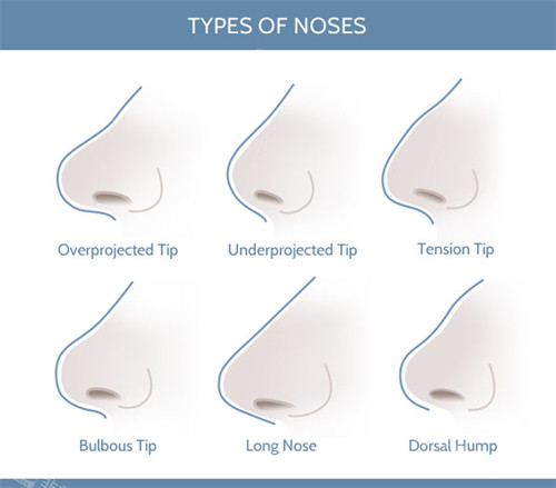 不同形態(tài)的鼻子