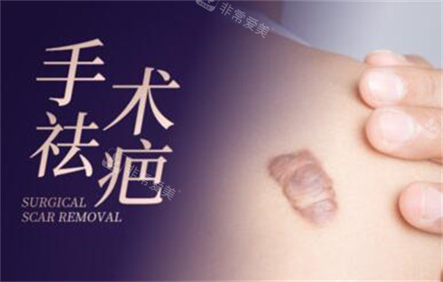 手术疤痕祛除改善图 手术疤痕祛除改善图