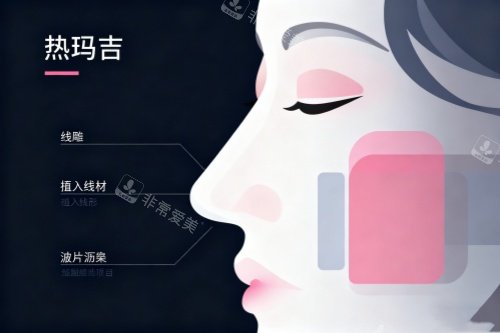 面部做热玛吉卡通图