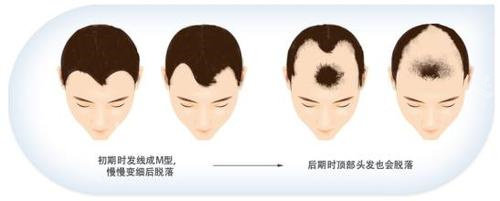 西安銳逸植發(fā)預(yù)約掛號(hào)...