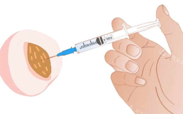 私密注射緊縮針照片 私密注射緊縮針照片