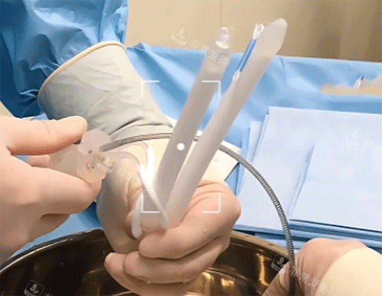 男性私密三件套假体