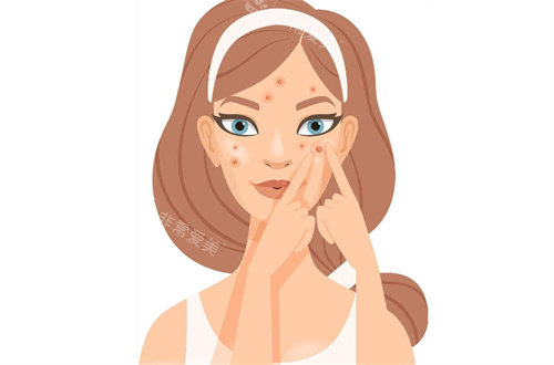  厦门悟空祛痘医生介绍：陈晓明|林悦医生技术出众，祛痘实力获认可