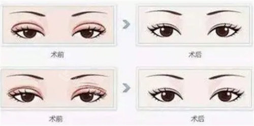 想在韩国丽珍整形外科...