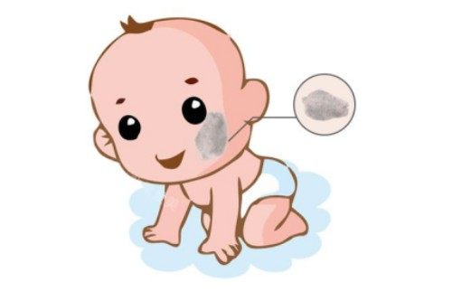 脸上胎记卡通图