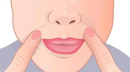 面部法令紋 面部法令紋