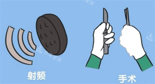 陰道緊縮有射頻和手術(shù)多種方式 陰道緊縮有射頻和手術(shù)多種方式