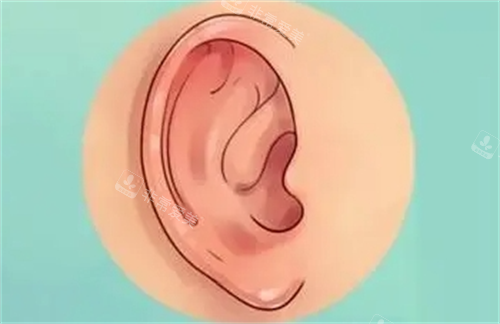 耳輪廓耳畸形動(dòng)畫(huà)展示 耳輪廓耳畸形動(dòng)畫(huà)展示