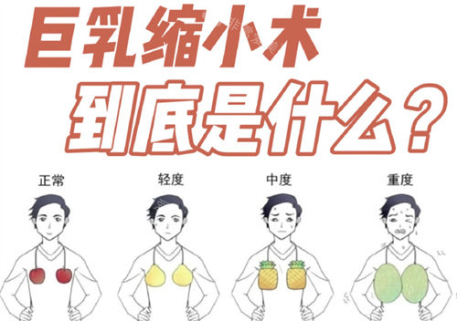 巨乳缩小术是什么 巨乳缩小术是什么