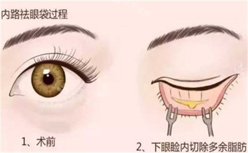 许昌辰星医疗美容怎么样?王振邦院长技术靠谱,祛眼袋可放心预约!