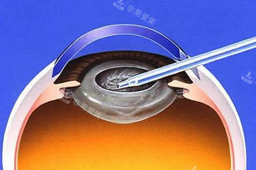 富贵包展示动画图