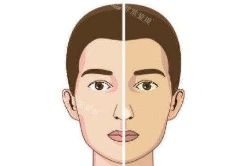 面部美白卡通對比圖