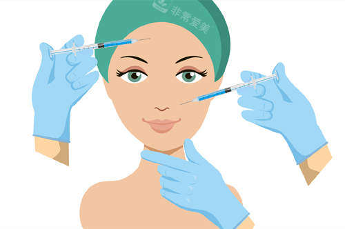 面部填充注射圖 面部填充注射圖