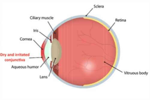 干眼症眼结构图