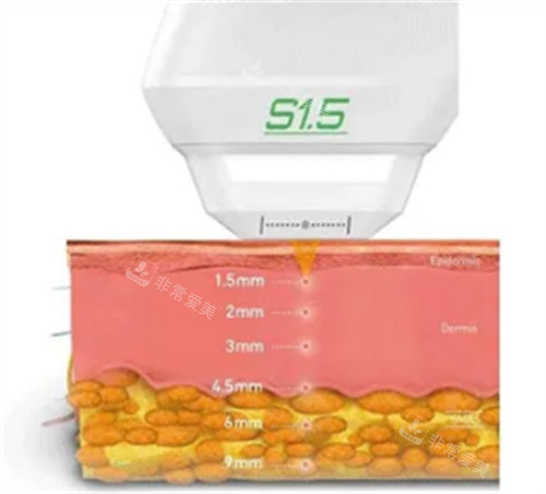 首爾皮膚管理去哪？planew皮膚科醫(yī)院，瑞草區(qū)核心位置便捷預(yù)約