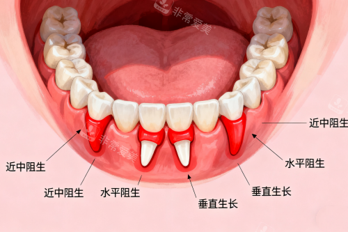 各类型智齿卡通图
