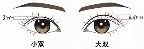 双眼皮宽度示意图 双眼皮宽度示意图