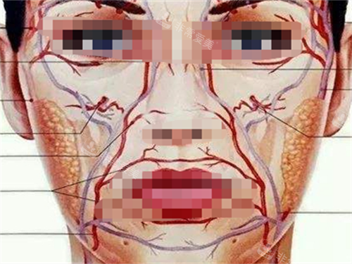 玻尿酸栓塞静脉动脉展示图 玻尿酸栓塞静脉动脉展示图