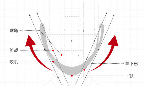 双颚手术的线条展示 双颚手术的线条展示
