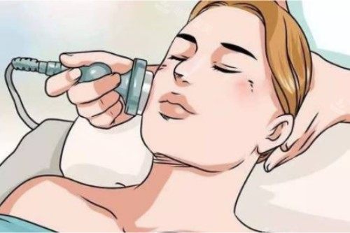 去疤痕卡通图片展示 去疤痕卡通图片展示