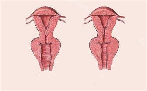 玻尿酸美容外观图