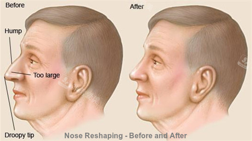 韩国丽尔丽整形外科探店：院内环境好服务贴心，面诊仔细报价不贵！