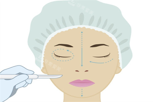 眼综合手术卡通图 眼综合手术卡通图