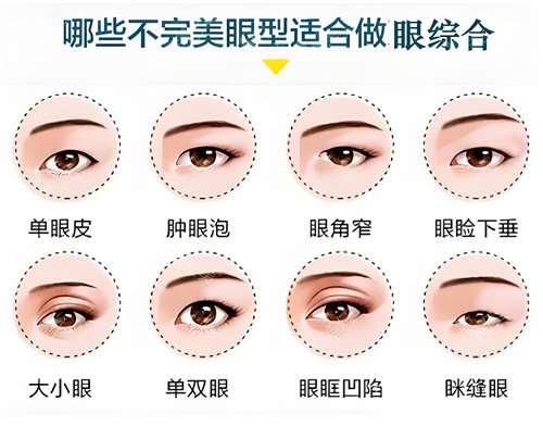 哪些眼型适合做眼综合示例动画图 哪些眼型适合做眼综合示例动画图