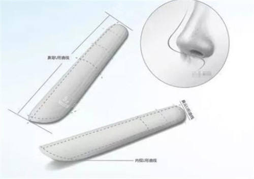 隆鼻假体形状图解 隆鼻假体形状图解