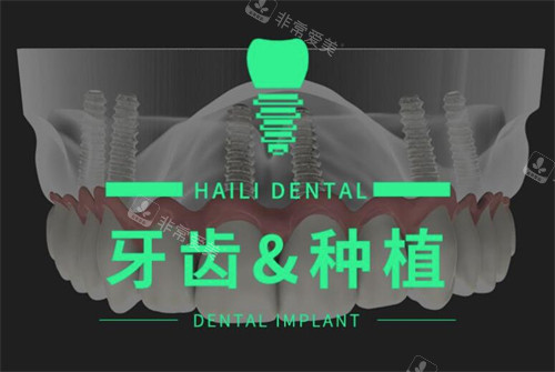 广州海狸口腔种植牙