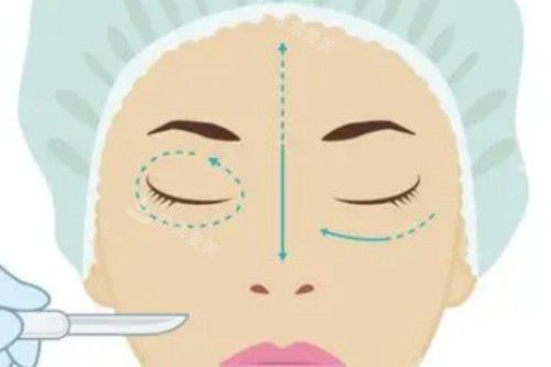 徐州三院和四院做眼袋哪家好？内窥镜技术vs精细化操作，医生资质、价格明细、术后反馈一站解析