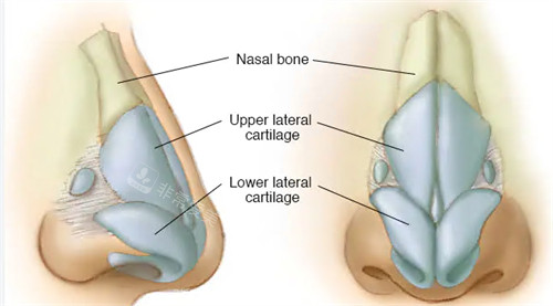 隆鼻手术动画图示 隆鼻手术动画图示