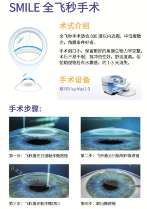 全飞秒近视手术术式介绍图解