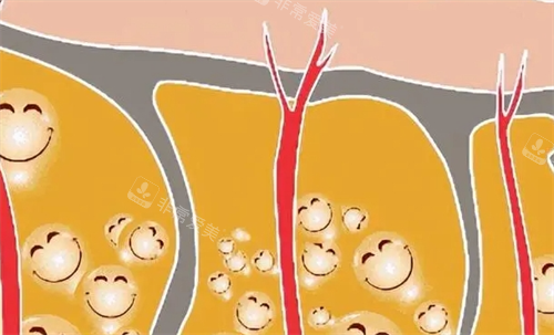 脂肪透视形象展示图 脂肪透视形象展示图