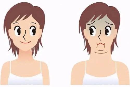双下巴消除卡通对比图 双下巴消除卡通对比图