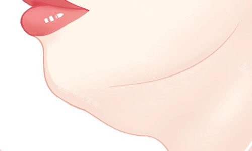 双下巴的动画图 双下巴的动画图