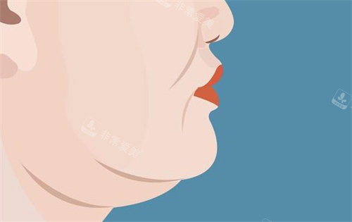 双下巴的样子卡通图 双下巴的样子卡通图