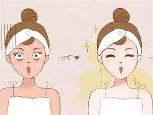 光子嫩肤前后的对比 光子嫩肤前后的对比