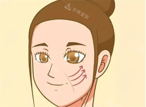 拉皮手术图片 拉皮手术图片