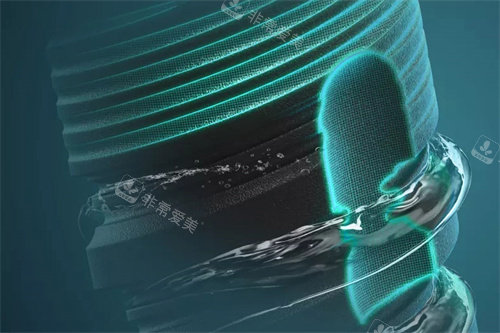 德国ABT种植牙削切槽设计