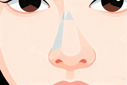 隆鼻卡通图片展示 隆鼻卡通图片展示