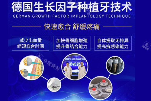 贵阳柏德口腔医院种植牙优势