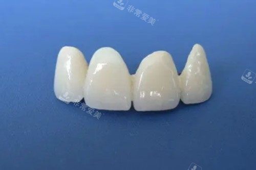 全瓷牙模型展示图