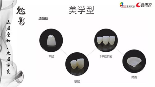 爱尔创全瓷牙魅影美学型适应症