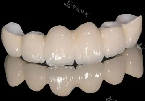二氧化锆全瓷牙模型展示