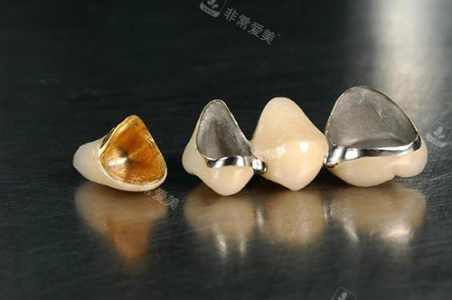 全瓷牙冠材料展示