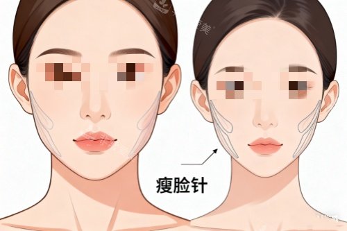 东莞维多利亚整形谁打...